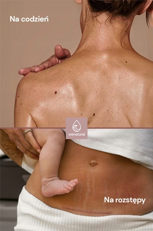 zdjęcie 5